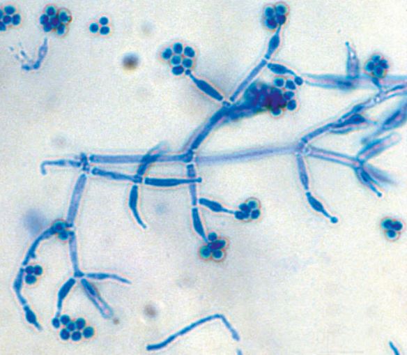 Microscopic view of a Trichoderma mold’s structure and spores.