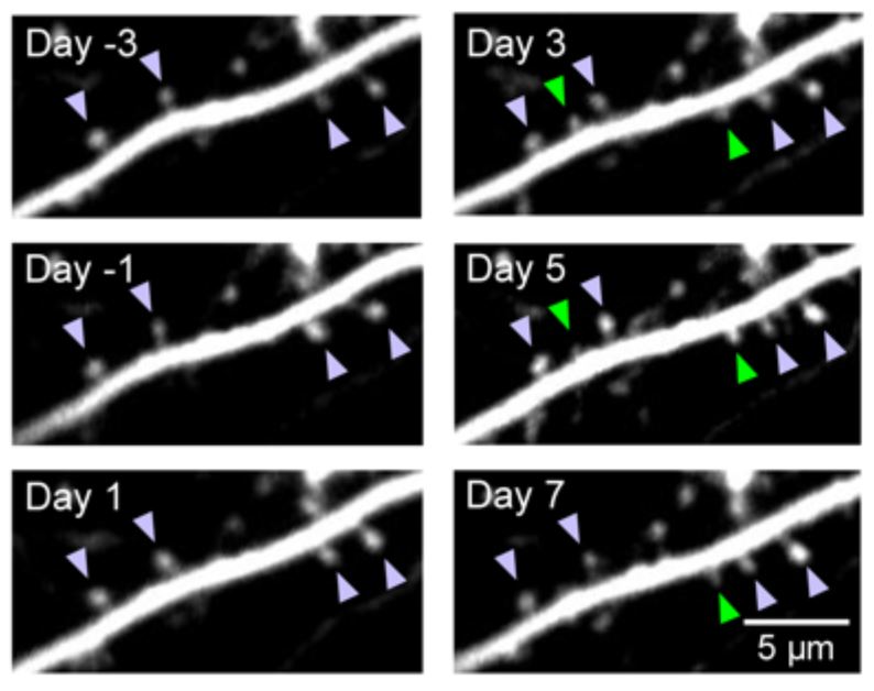 Microscope images of new dendritic spines growing after psilocybin treatment.