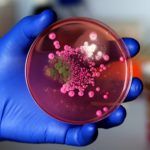 Hand of a researcher showing a close-up of a microbiological culture plate with mold and yeast