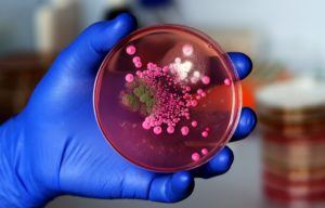 Hand of a researcher showing a close-up of a microbiological culture plate with mold and yeast