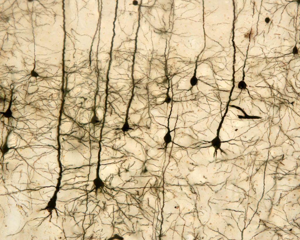 Pyramidal neurons of the cerebral cortex stained with the Golgi silver chromate. From the conic shaped soma, a large apical dendrite and multiple basal dendrites originate.